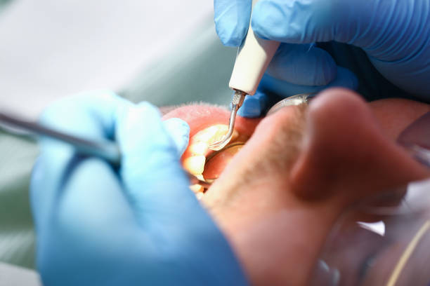 Best Weekend Emergency Dentist in Moody Af, GA